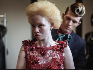 Un concours de beauté pour albinos [vidéo]