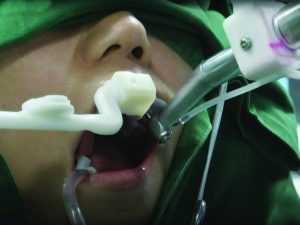 Robot dentiste [vidéo]
